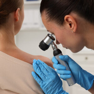 Doctor performing a skin check using a dermatoscope