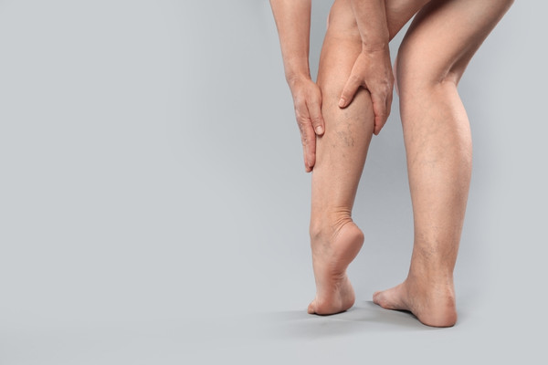 Leg vein treatment