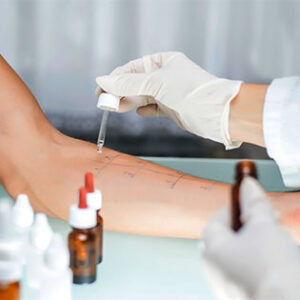 Skin prick testing