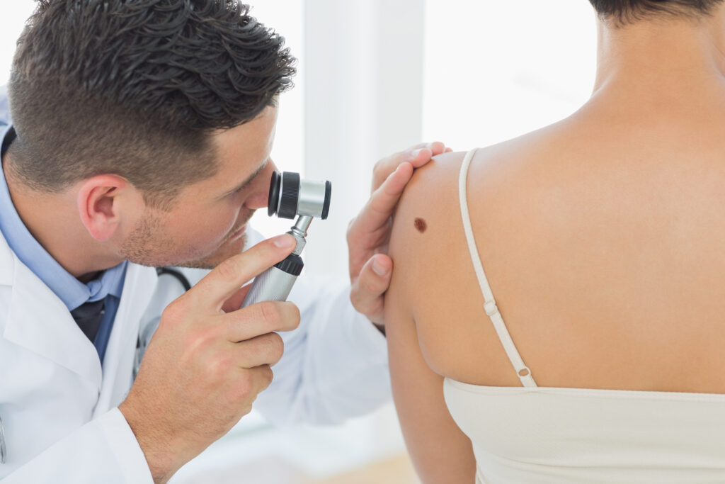 skincheck